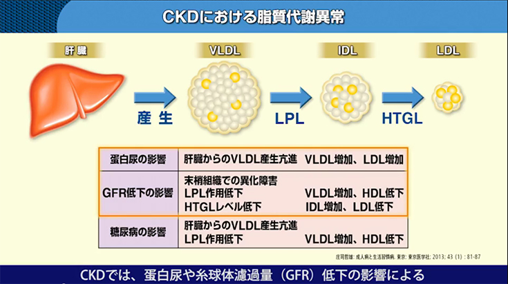 CKDと高中性脂肪（TG）血症